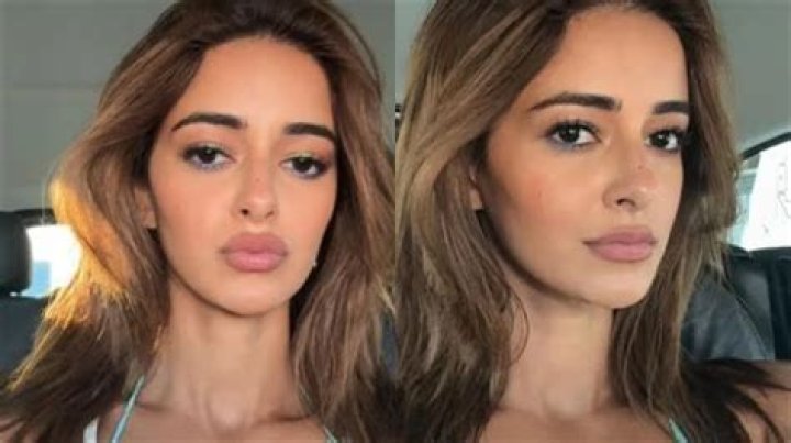 Alanna Panday: The Journey of Transformation Through Surgeries