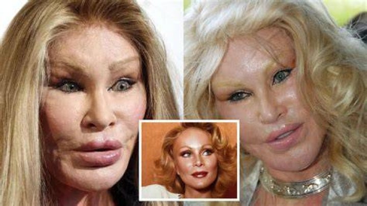 Exploring the Transformation: Jocelyn Wildenstein Before Surgery