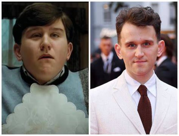 Harry Melling: From Child Star to Acclaimed Actor