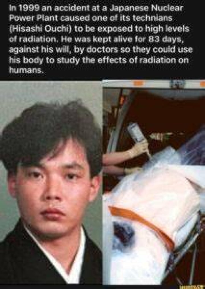 Hisashi Ouchi: A Heartbreaking Tale and Photos from the Hospital