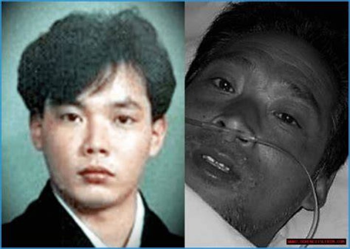Hisashi Ouchi Photos: A Deep Dive into the Life and Legacy of a Tragic Figure