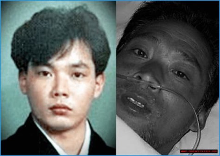 Hisashi Ouchi Photos Graphic: A Deep Dive into the Tragic Story
