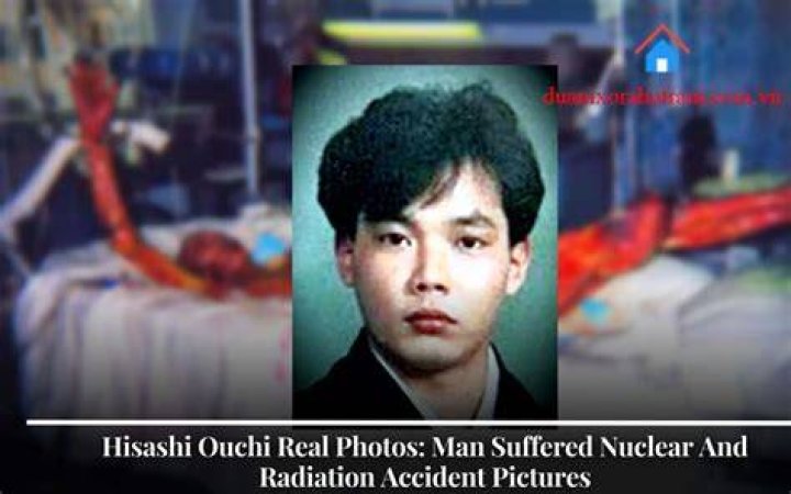 Hisashi Real Photos Day 85: A Journey Through Captivating Moments