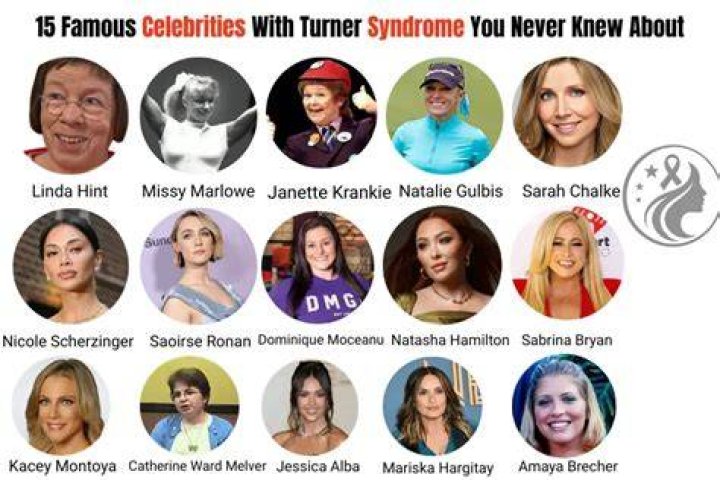 Inspiring Female Celebrities with Turner Syndrome