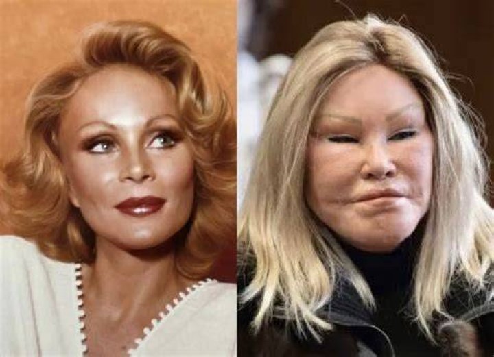 Jocelyn Wildenstein: The Enigmatic Transformation Before Plastic Surgery