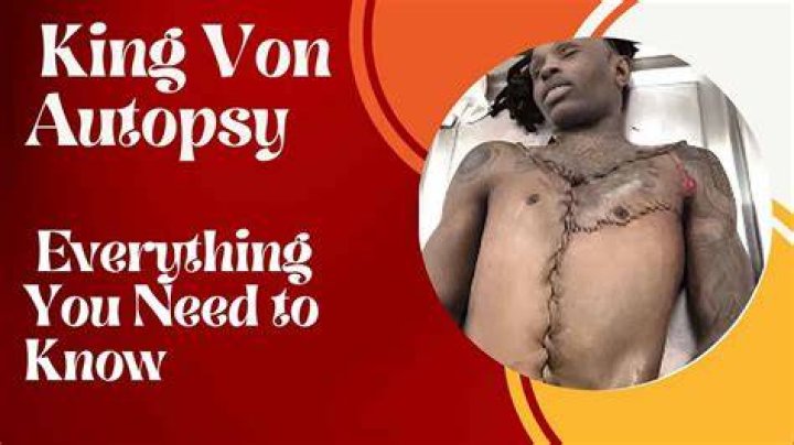 King Von's Autopsy: A Comprehensive Analysis of the Findings