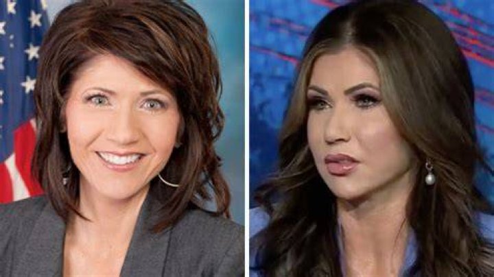 Kristi Noem Before and After Plastic Surgery: A Comprehensive Analysis