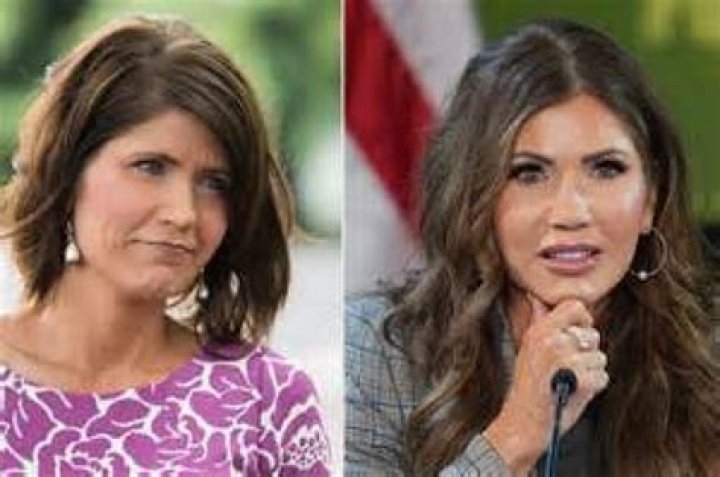 Kristi Noem Plastic Surgery: Exploring the Truth Behind the Rumors