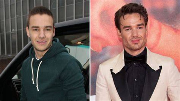 Liam Payne Surgery: A Journey Through Recovery