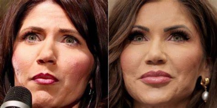 Noem Plastic Surgery: A Comprehensive Guide to Cosmetic Procedures