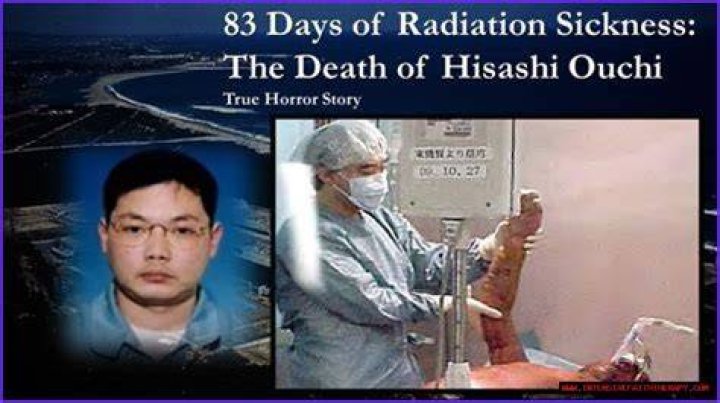 **The Tragic Tale of Hisashi Ouchi: A Survivor's Journey**