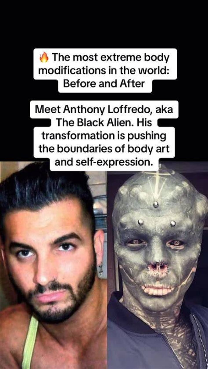 Transforming the Body and Mind: The Journey of Anthony Loffredo