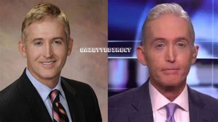 Trey Gowdy: A Closer Look at His Nose Before and After