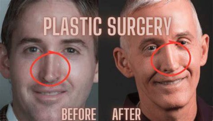 Trey Gowdy's Nose Surgery: A Closer Look at the Changes
