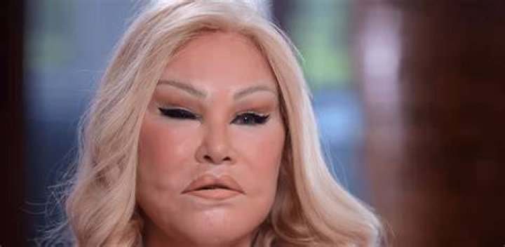 Unmasking Jocelyn Wildenstein: The Woman Behind the Legend