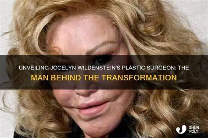 Unveiling Jocelyn Wildenstein: A Journey Through Transformation