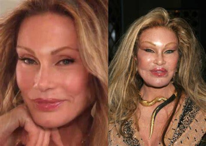 Unveiling Jocelyn Wildenstein Before the Transformation