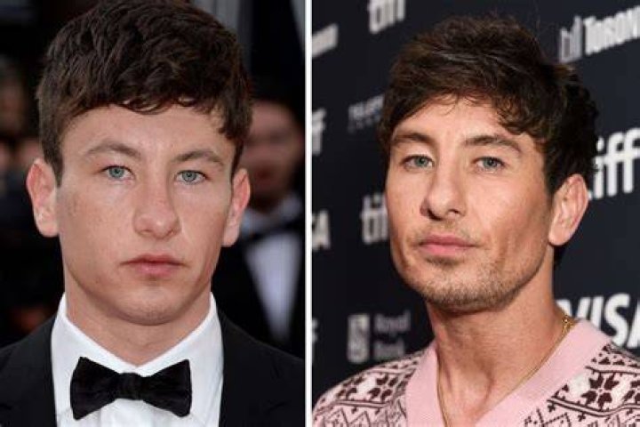 Unveiling the Truth Behind Barry Keoghan's Plastic Surgery Rumors