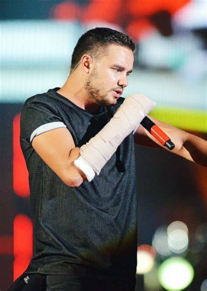 When Life Throws a Curveball: The Story of Liam Payne's Broken Arm